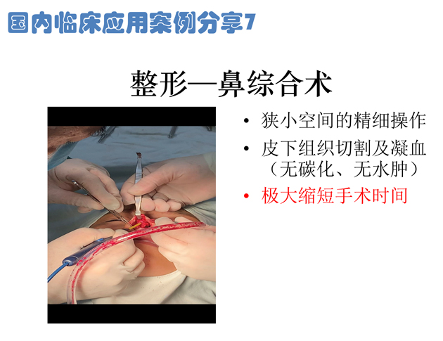 低溫射頻刀整形鼻綜合術(shù)應(yīng)用